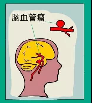 1577926572407861.jpg a.jpg