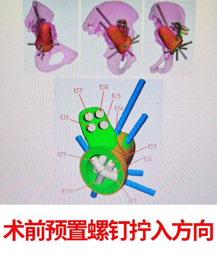 1649079819928509.jpg 03.jpg